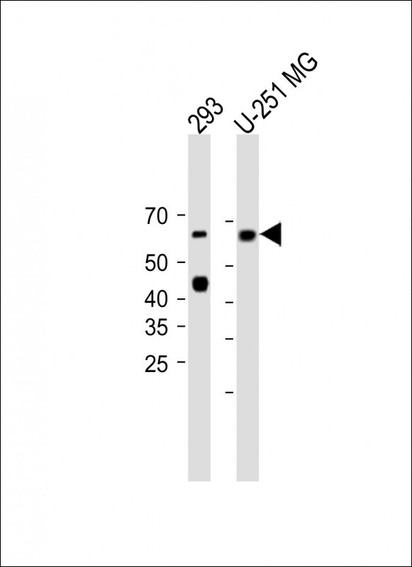 Rabbit Polyclonal Antibody to MCOLN1