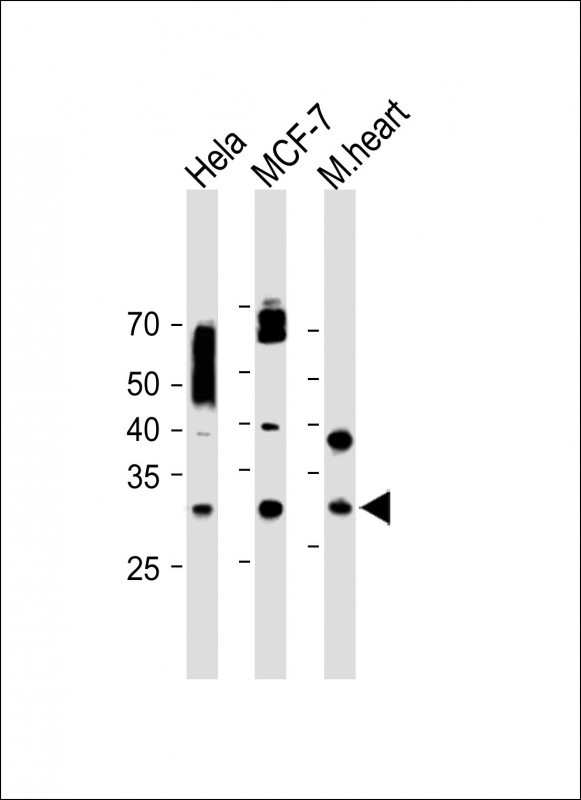 Rabbit Polyclonal Antibody to CYC1