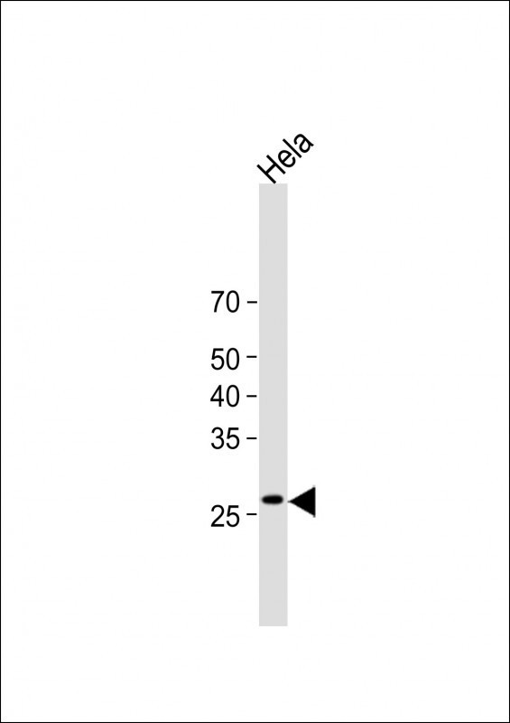 Rabbit Polyclonal Antibody to VAPB