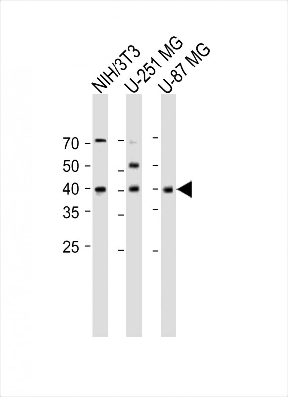 Rabbit Polyclonal Antibody to NKX2-1