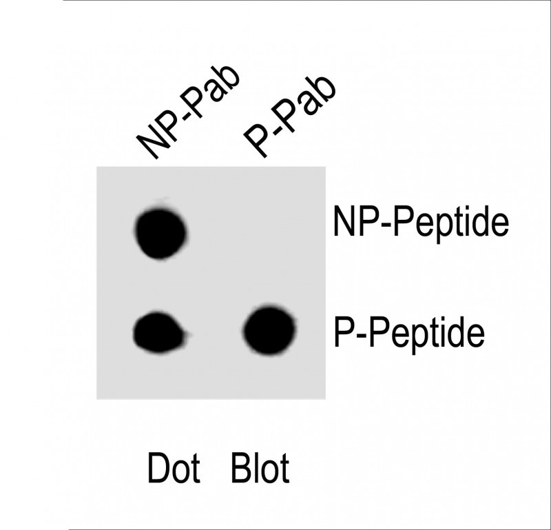 Rabbit Polyclonal Antibody to Phospho-RB(S612)