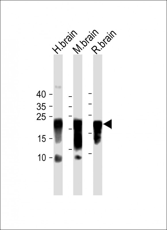 Mouse Monoclonal Antibody to SNCA