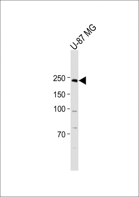Rabbit Polyclonal Antibody to DEPD5  (C-term)