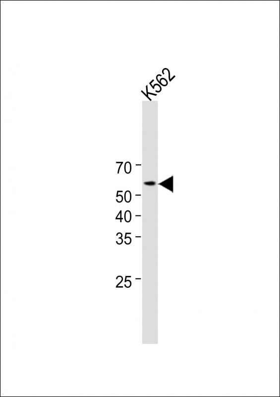 Rabbit Polyclonal Antibody to IL1RL2