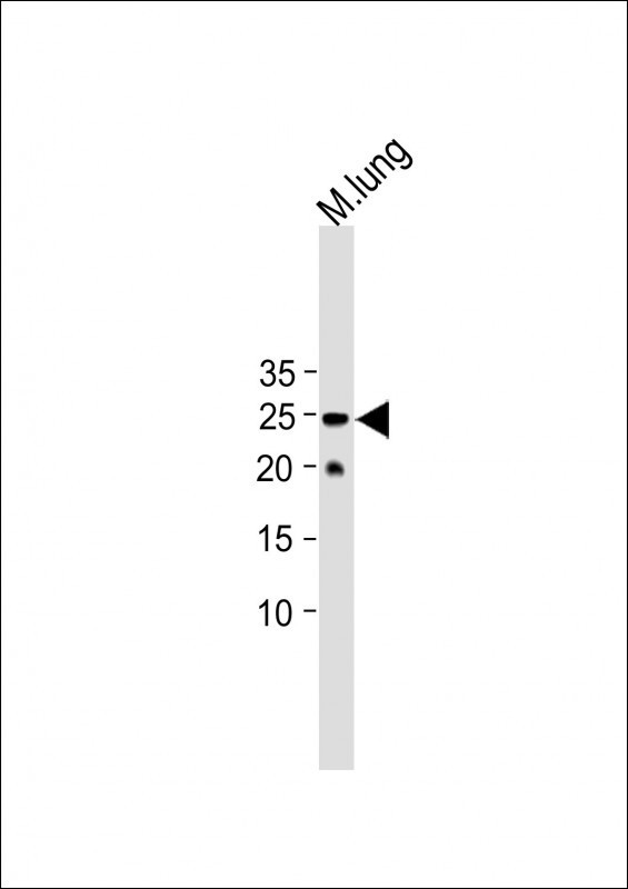 Rabbit Polyclonal Antibody to SOST (N-term)