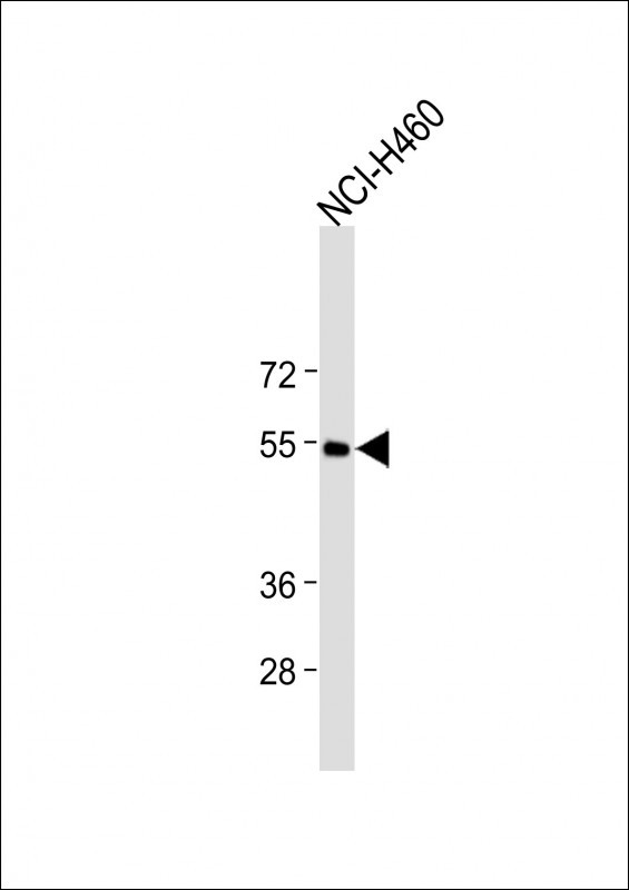 Rabbit Polyclonal Antibody to CXCR4(N-term)