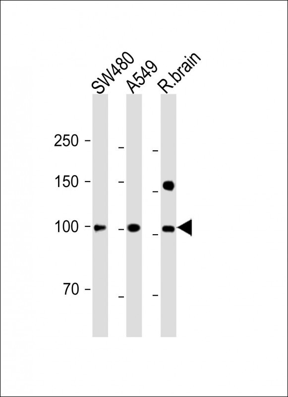 Rabbit Polyclonal Antibody to ANO6 (N-term)