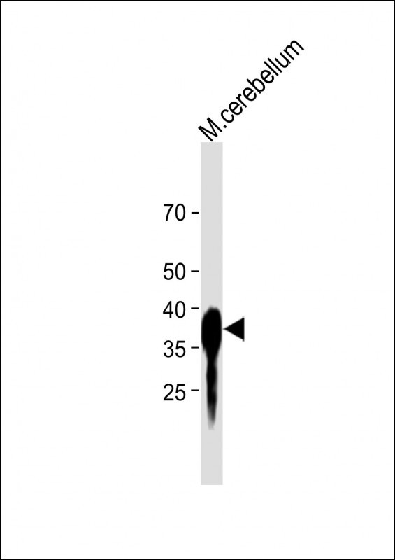 Rabbit Polyclonal Antibody to ALDOC