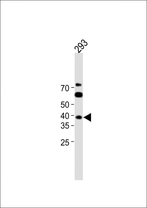 Rabbit Polyclonal Antibody to SERTAD4