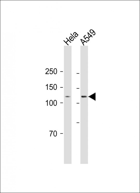 Rabbit Polyclonal Antibody to VLDLR