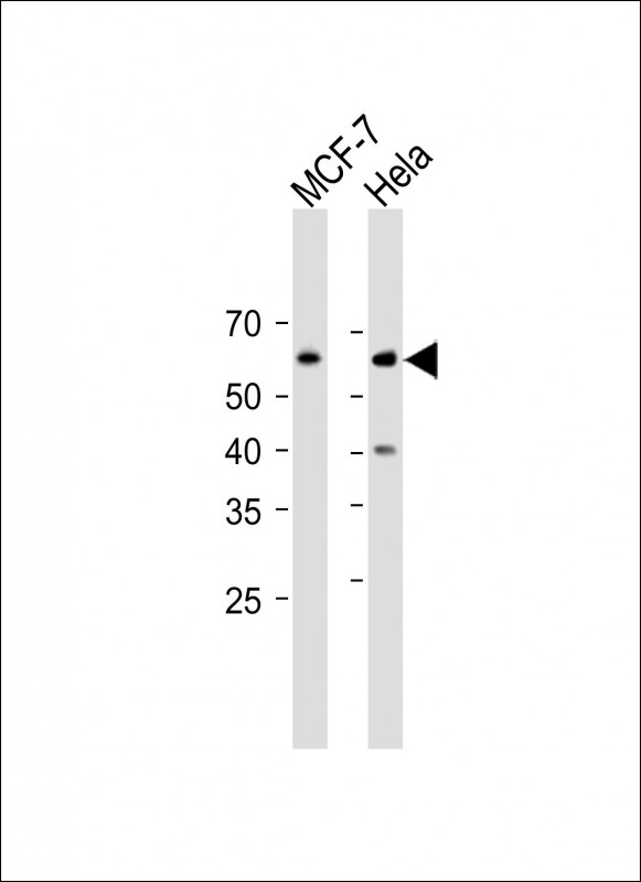 Rabbit Polyclonal Antibody to Phospho-CDC25A(S293)