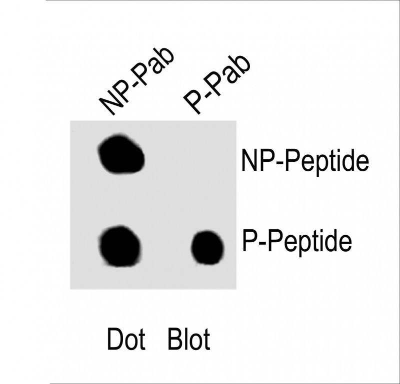 Rabbit Polyclonal Antibody to Phospho-Rb(S249)