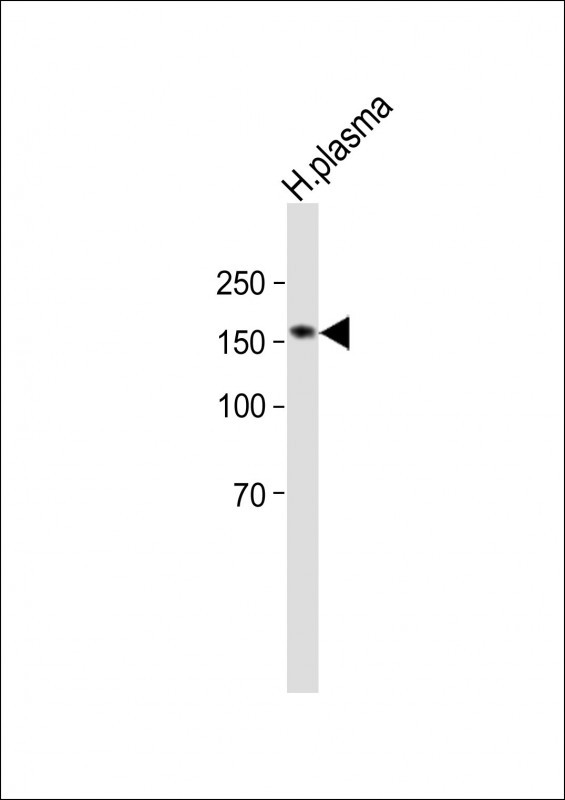 Rabbit Polyclonal Antibody to DDX60L