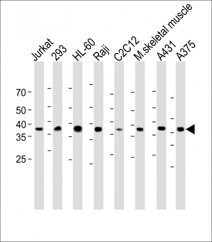 Rabbit Polyclonal Antibody to HIF1AN (N-term)