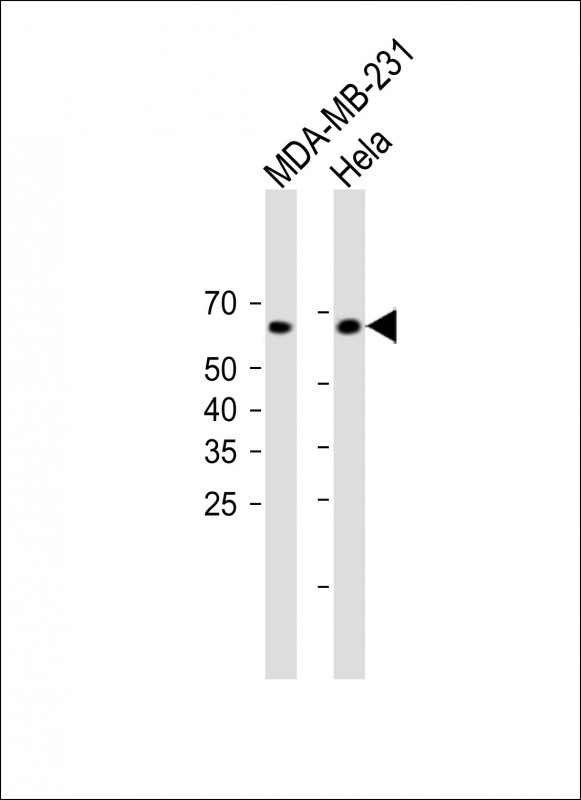 Rabbit Polyclonal Antibody to FUT8
