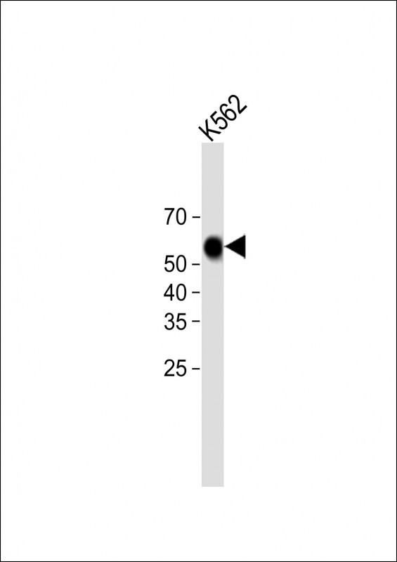 Rabbit Polyclonal Antibody to COCH