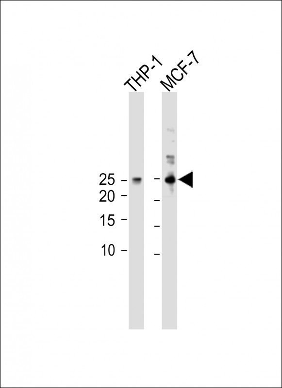 Rabbit Polyclonal Antibody to PTMA (N-term)