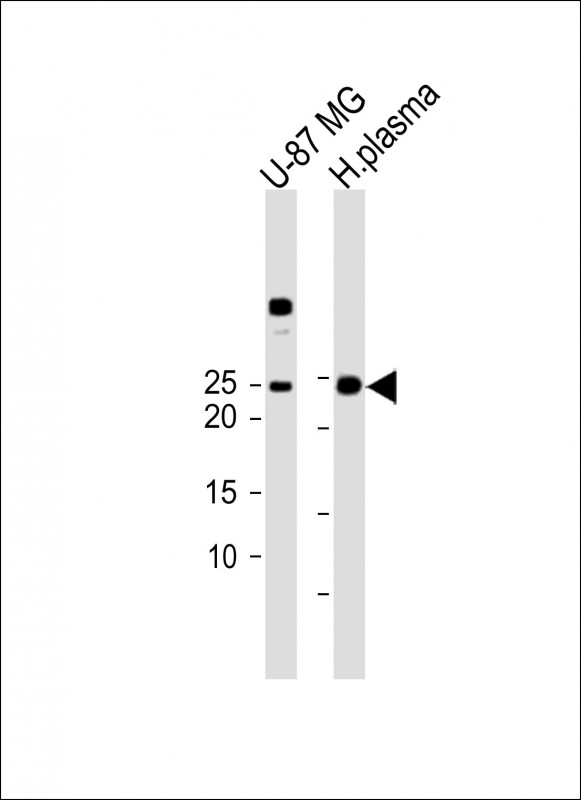 Rabbit Polyclonal Antibody to IL6