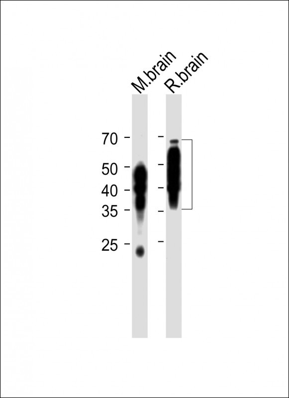 Rabbit Polyclonal Antibody to TAU (MAPT) (S720)
