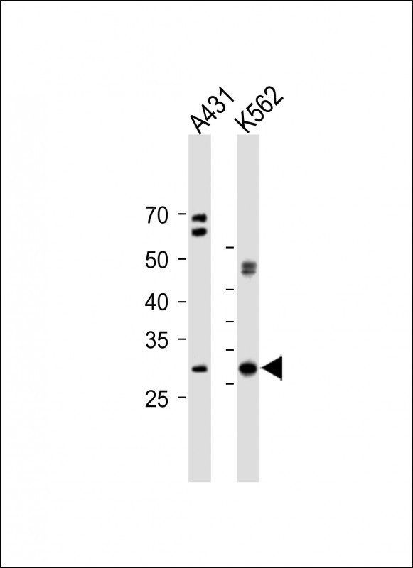 Rabbit Polyclonal Antibody to VCX3A (N-term)