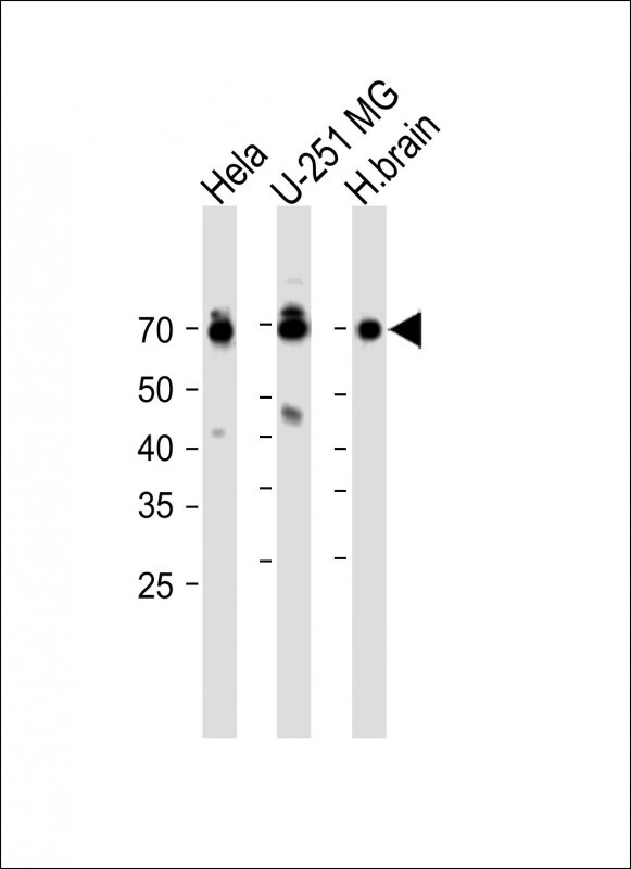 Rabbit Polyclonal Antibody to TMEM106B