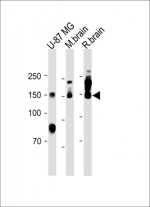 Rabbit Polyclonal Antibody to CD56