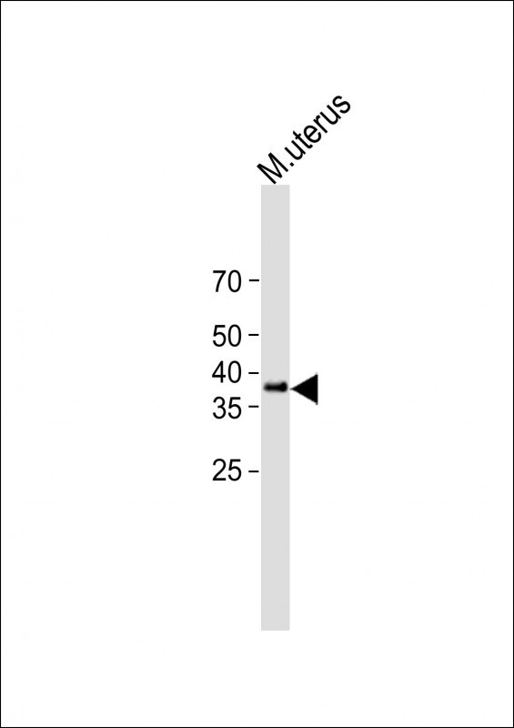 Rabbit Polyclonal Antibody to CLEC11A