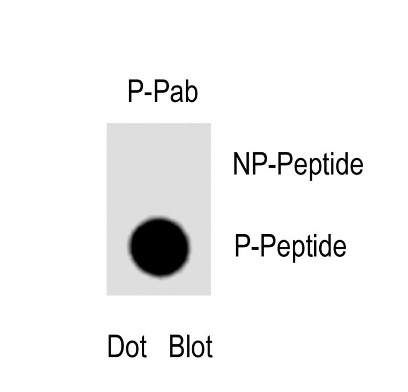 Rabbit Polyclonal Antibody to Phospho-Caspase 6(S257)