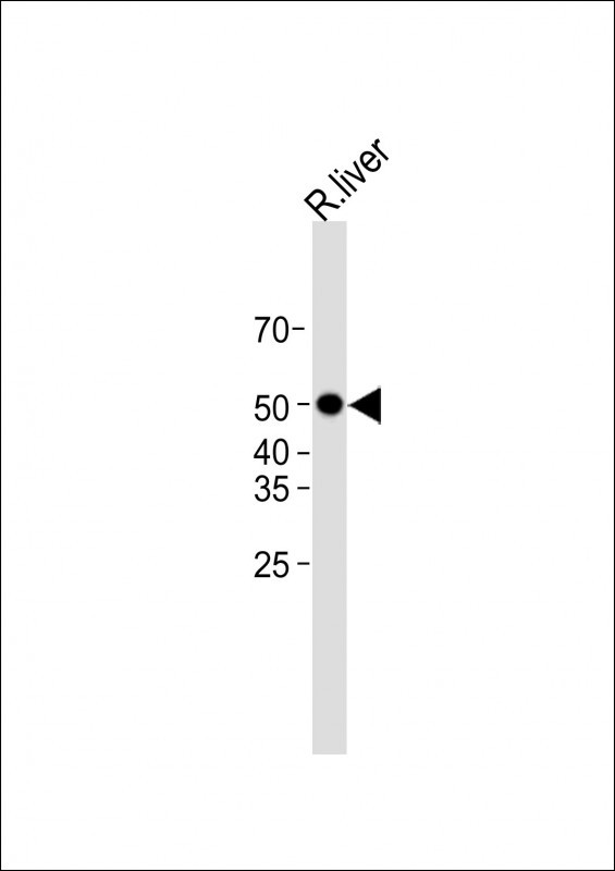Mouse Monoclonal Antibody to PAH