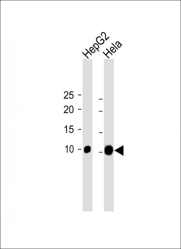 Rabbit Polyclonal Antibody to WFDC12