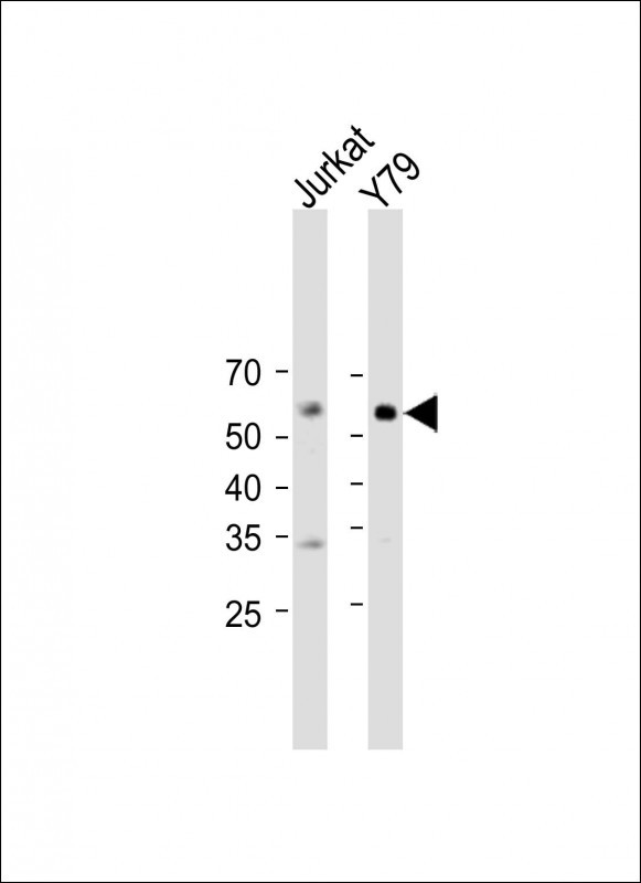 Rabbit Polyclonal Antibody to WDR51B