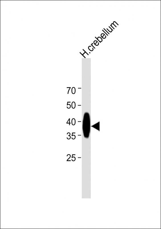 Rabbit Polyclonal Antibody to PQLC2