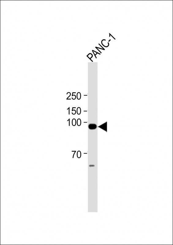 Rabbit Polyclonal Antibody to PPEF2