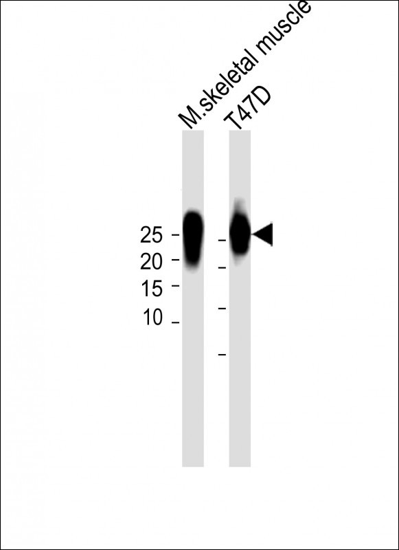 Rabbit Polyclonal Antibody to TNNI2 (N-term)