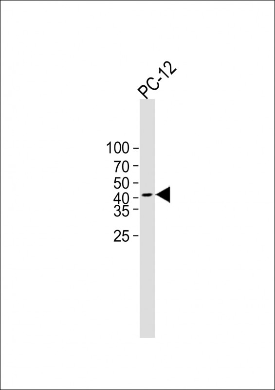 Rabbit Polyclonal Antibody to PDHE1A(S232)