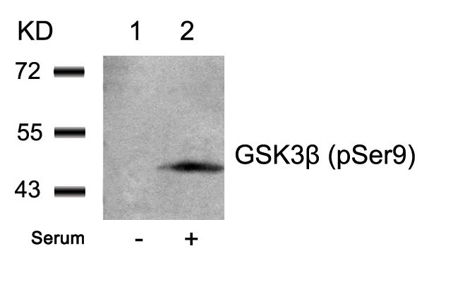 Rabbit Polyclonal Antibody to GSK3β(Phospho-Ser9)