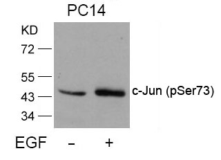 Rabbit Polyclonal Antibody to c-Jun(Phospho-Ser73)