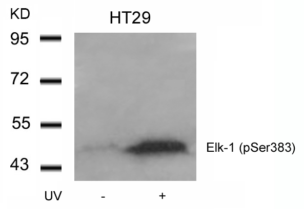 Rabbit Polyclonal Antibody to Elk-1(Phospho-Ser383)
