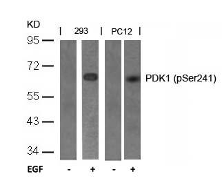 Rabbit Polyclonal Antibody to PDK1(Phospho-Ser241)