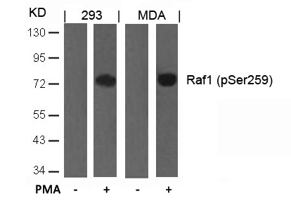 Rabbit Polyclonal Antibody to Raf1(Phospho-Ser259)