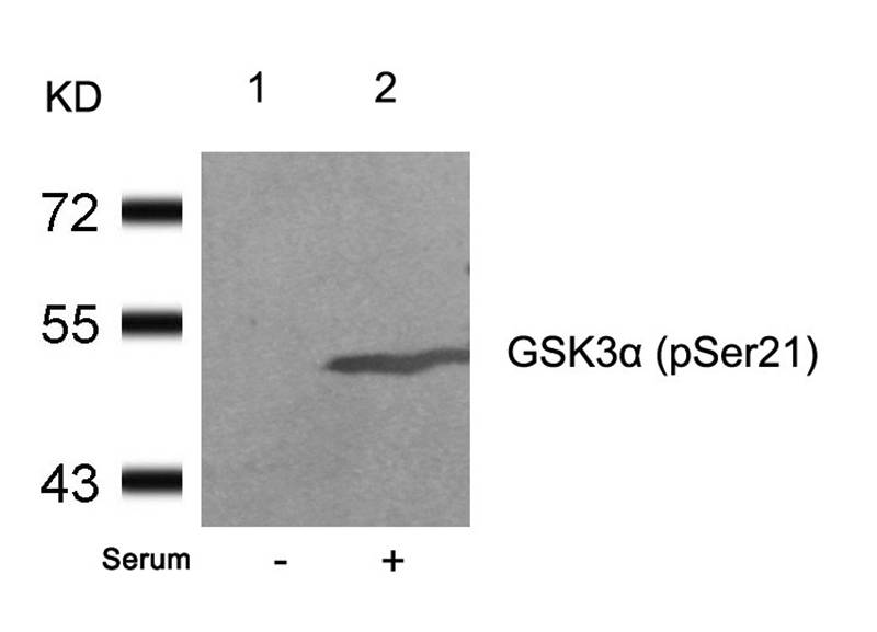 Rabbit Polyclonal Antibody to GSK3a(Phospho-Ser21)