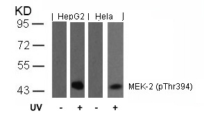 Rabbit Polyclonal Antibody to MEK2(Phospho-Thr394)