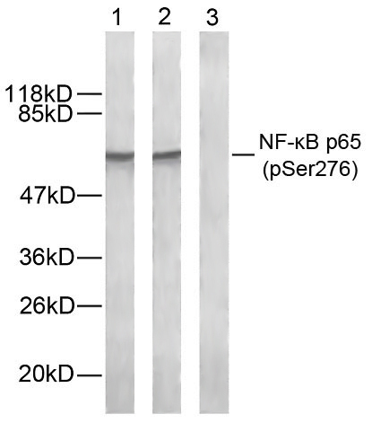 Rabbit Polyclonal Antibody to NFkB-p65(Phospho-Ser276)