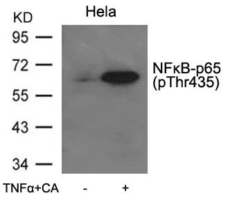 Rabbit Polyclonal Antibody to NFkB-p65(Phospho-Thr435)