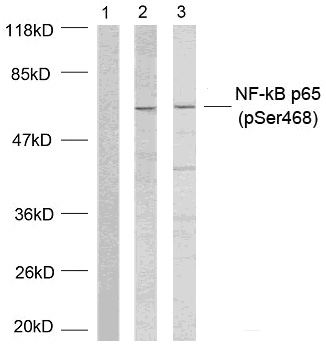 Rabbit Polyclonal Antibody to NFkB-p65(Phospho-Ser468)