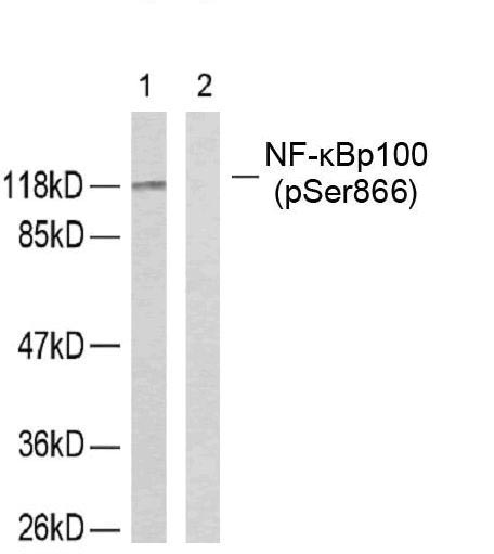 Rabbit Polyclonal Antibody to NFkB-p100(Phospho-Ser866)