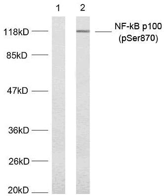Rabbit Polyclonal Antibody to NFkB-p100(Phospho-Ser870)