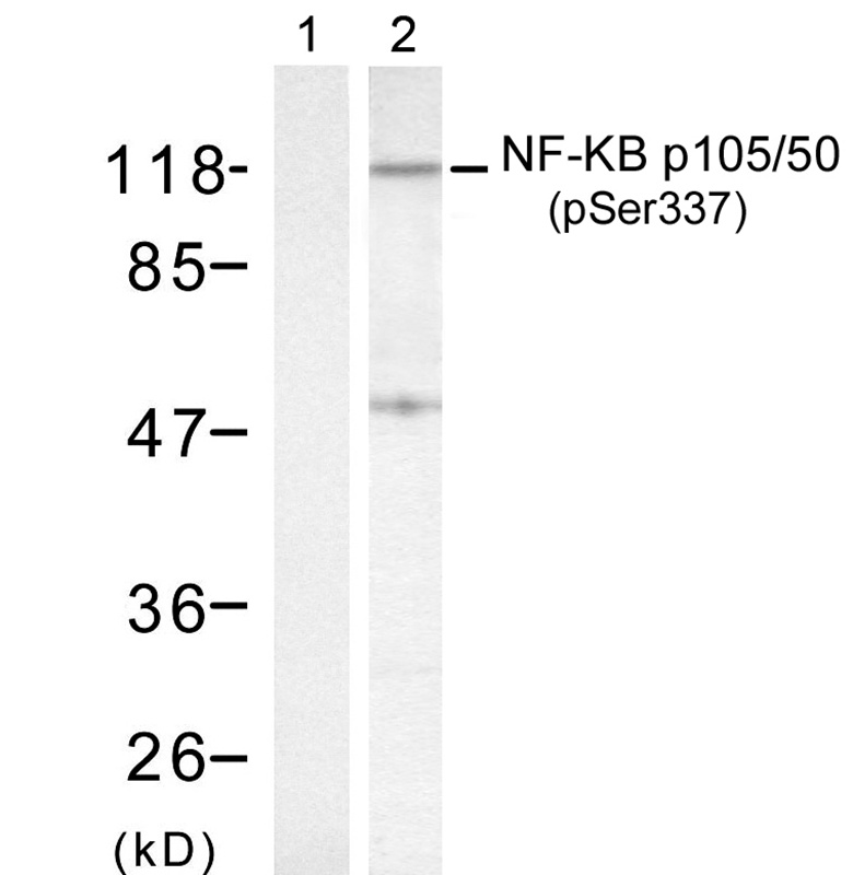 Rabbit Polyclonal Antibody to NFkB-p105/p50(Phospho-Ser337)