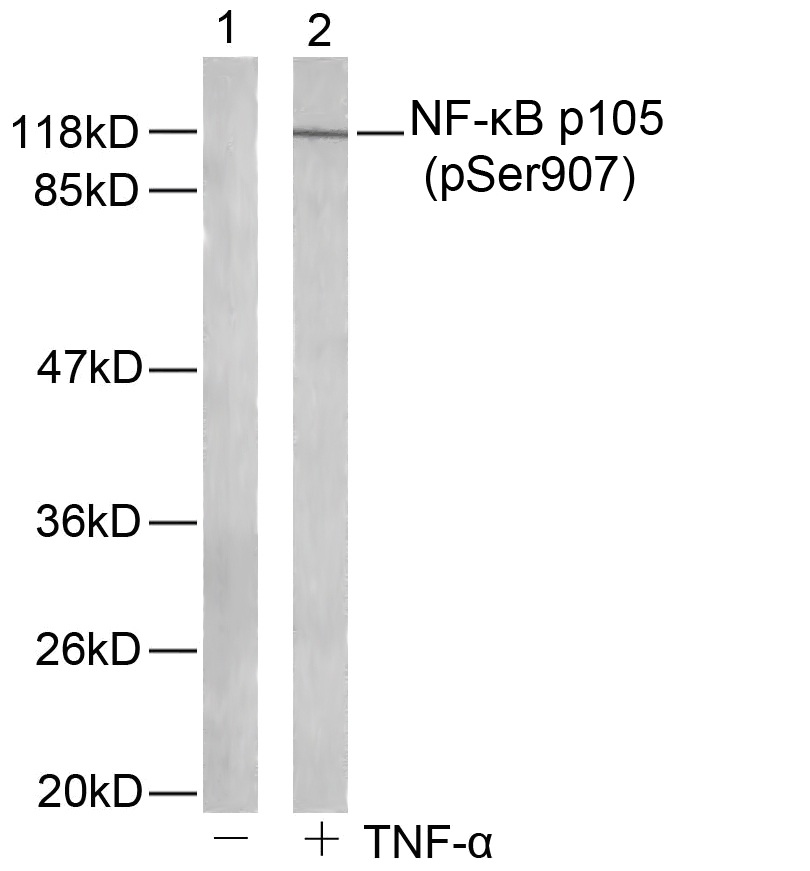 Rabbit Polyclonal Antibody to NFkB-p105(Phospho-Ser907)