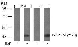 Rabbit Polyclonal Antibody to c-Jun(Phospho-Tyr170)